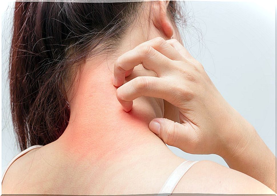 Itchy skin, a symptom of kidney disease