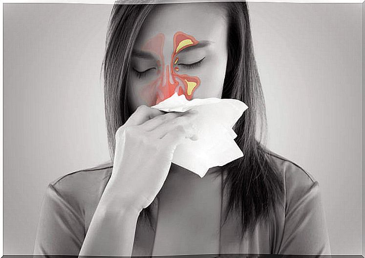 Woman with sinusitis