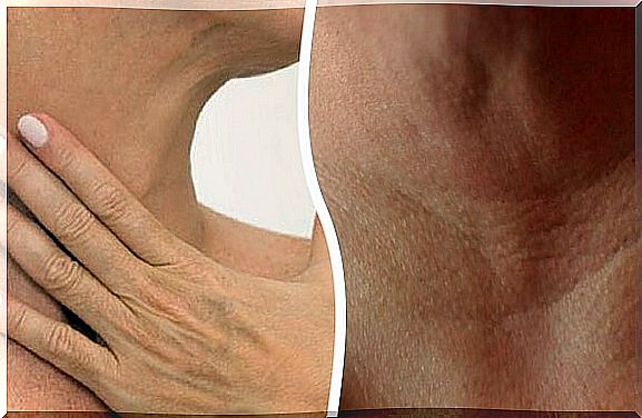 4 natural treatments to prevent the appearance of wrinkles on the neck and hands