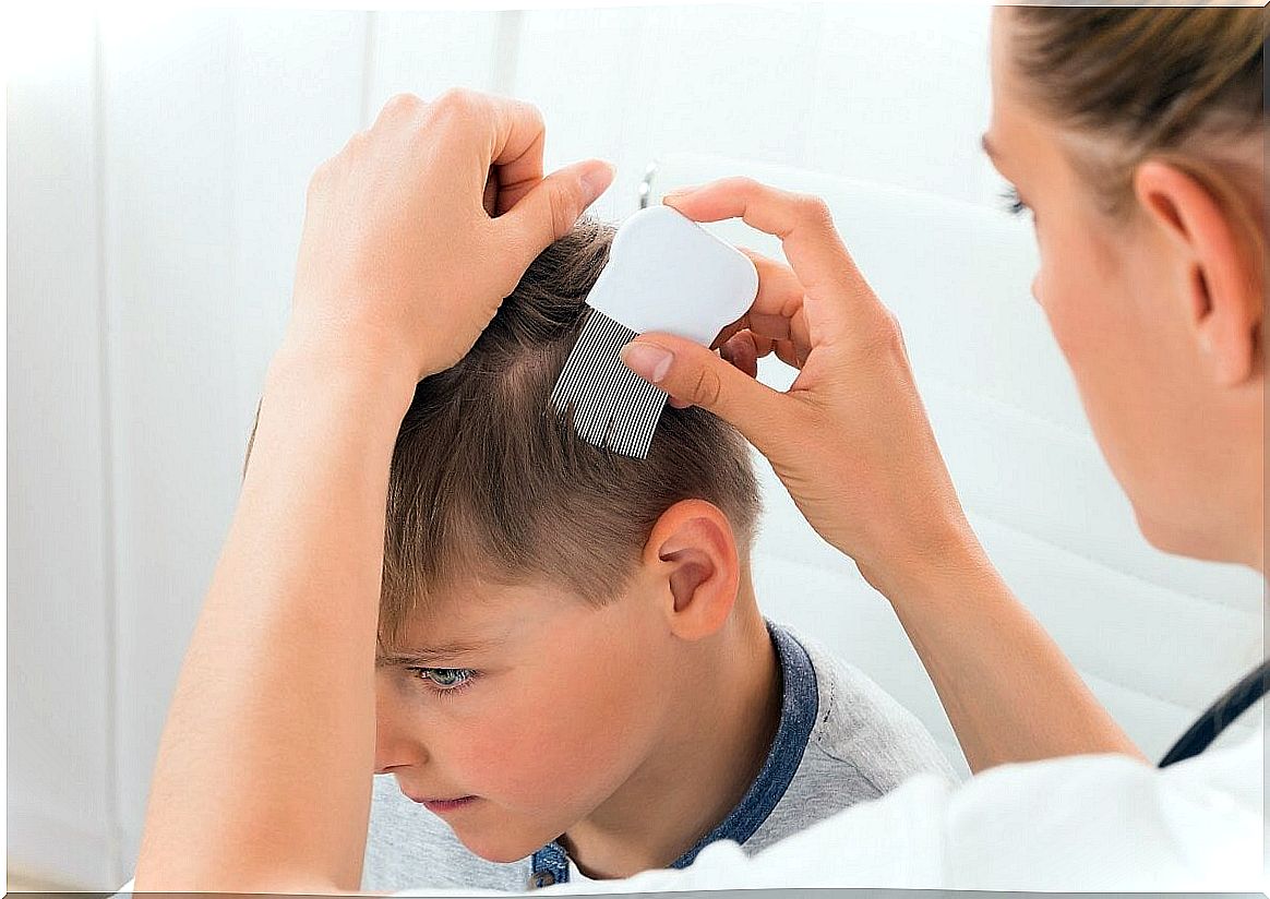 What is alopecia in children?