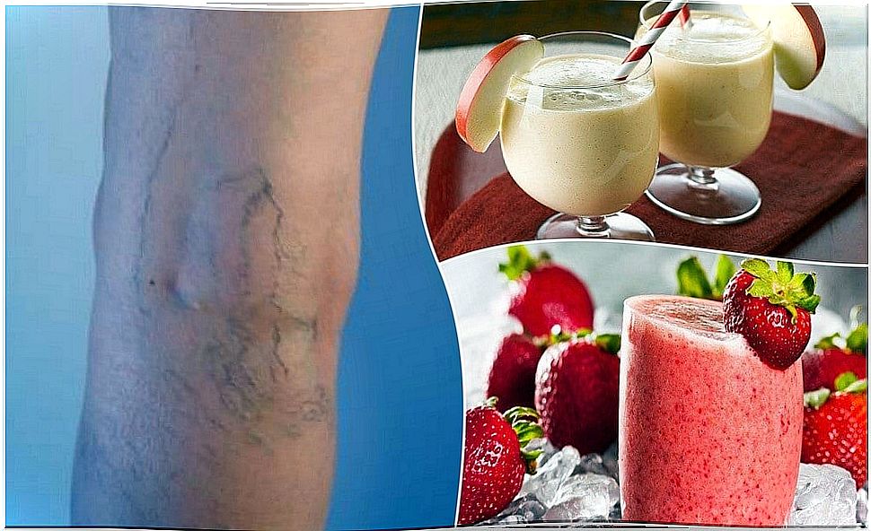 Reduce varicose veins and circulatory problems with 5 shakes