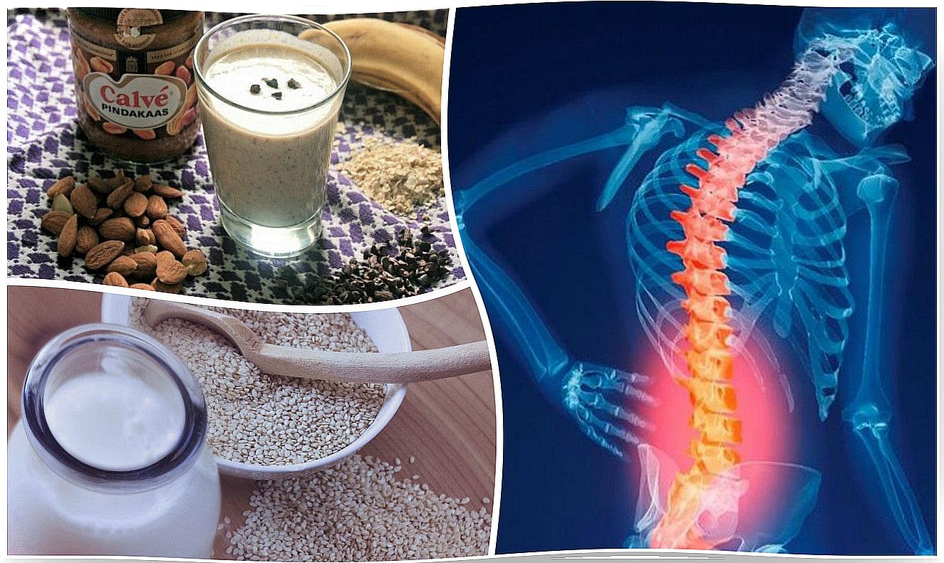 The 6 best natural remedies to prevent osteoporosis