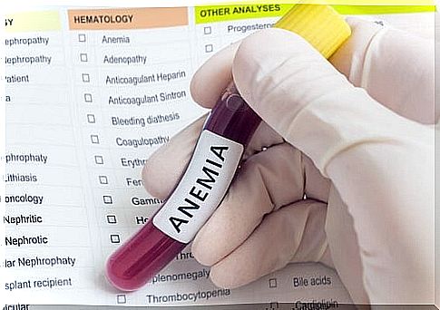 Anemia is one of the main markers of iron deficiency.