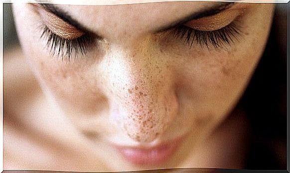 These 6 natural solutions will help you remove spots and blackheads