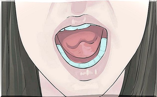 What the color of your tongue says about your health