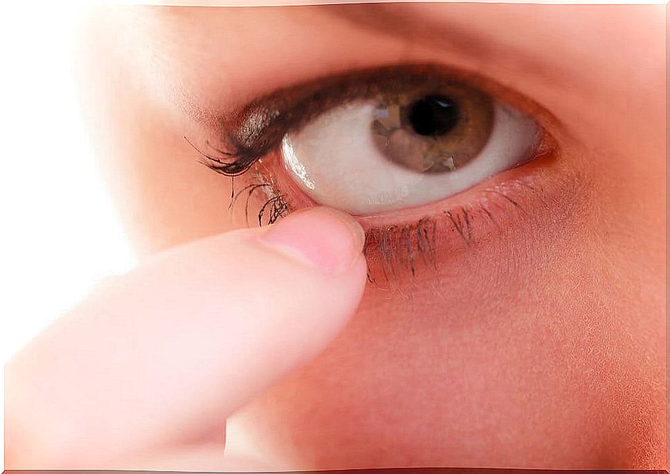 Eye effusions can manifest as itching or irritation of the eye